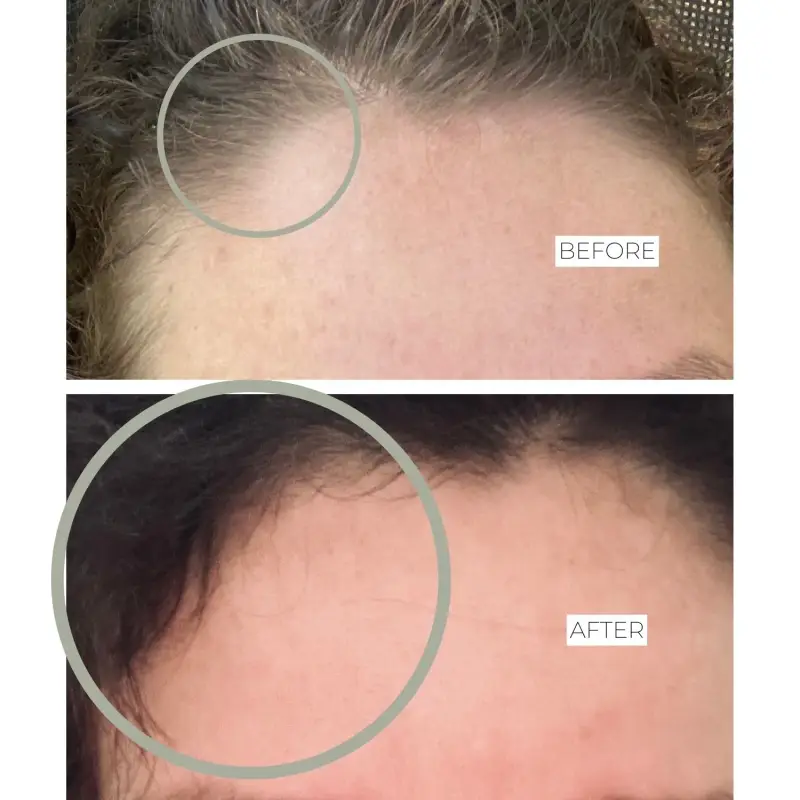 Integratori Stop & Grow Hair - Integratori capelli miniatura 4