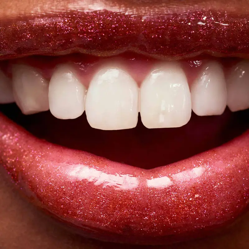 Labbra 3D Glitter Gloss Disco Fever - Gloss miniatura 3