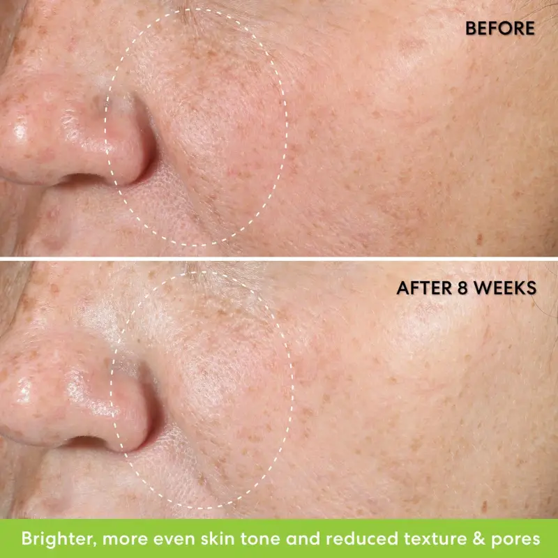 Skincare Ageless 10% Phyto-Retinol Night Concentrate - Trattamento antietà pelli mature, Crema antirughe miniatura 5