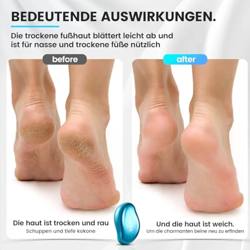 BEZOX 2in1 Lima per Piedi in Nano Vetro per Una Rimozione Delicata di Calli e Duroni, Lima per Talloni Screpolati, Rimuove e Ammorbidisce la Pelle con Calli e Talloni Screpolati miniatura 3