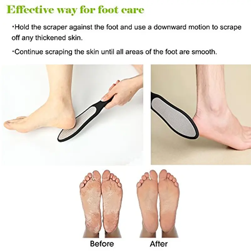 BEZOX Professionale Lima Per Piedi - Calli Remover Pedicure Per Callosità - Ammorbidisce Dry Talloni Screpolati la Pelle - Acciaio Inox miniatura 3