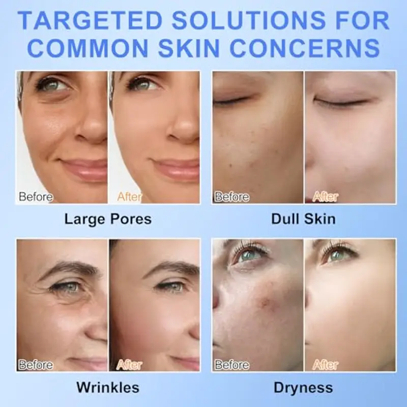 Bio Collagen Real Deep Mask, 6 pezzi Bio-Collagen Real Deep Mask Overnight Coreane, Maschera Viso Collagene, Anti miniatura 3