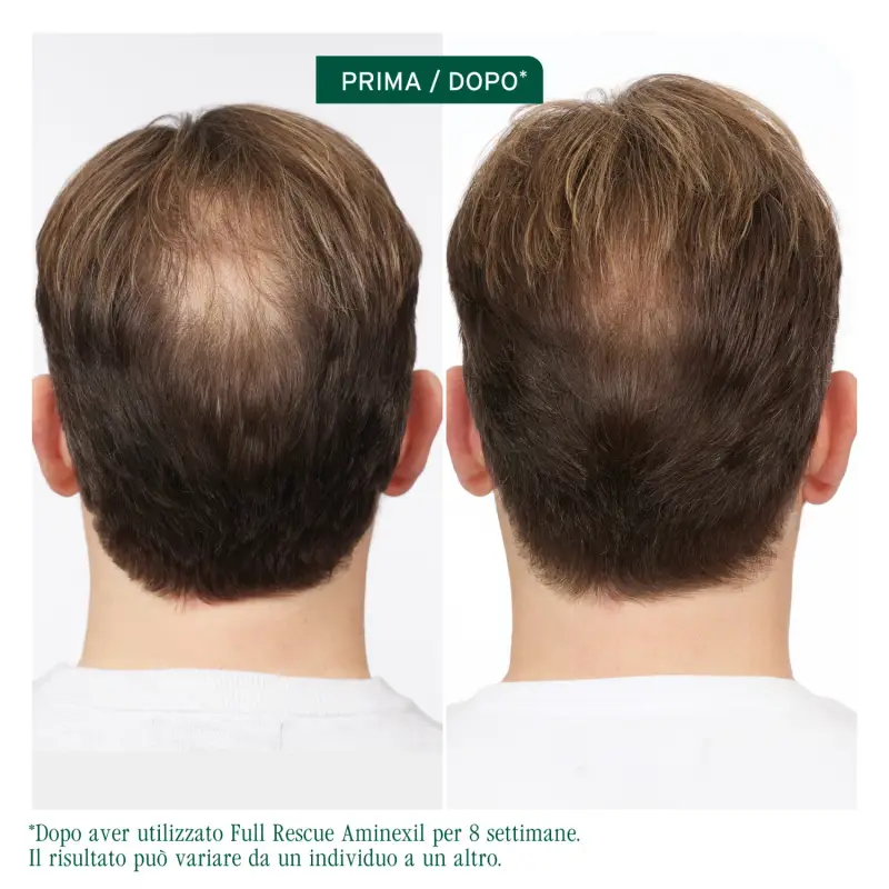 Full Rescue Trattamento Aminexil - Caduta dei capelli miniatura 3