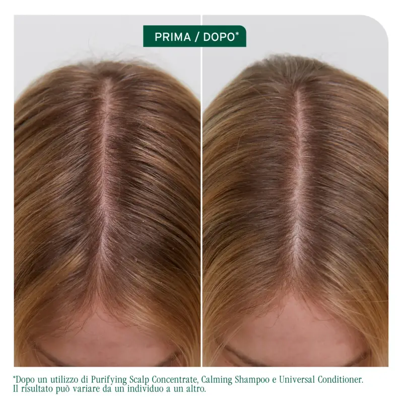 Scalp Sync Clarifying Shampoo - Shampoo purificante, Capelli grassi miniatura 4