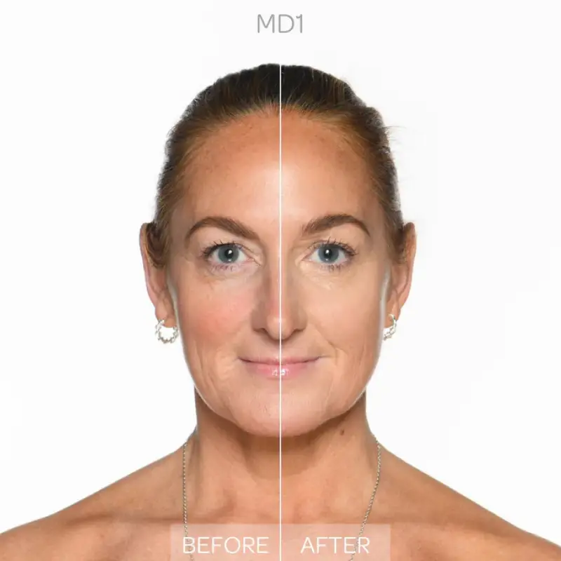 Viso Full Impact Concealer Med-Deep 1 - Correttori miniatura 2