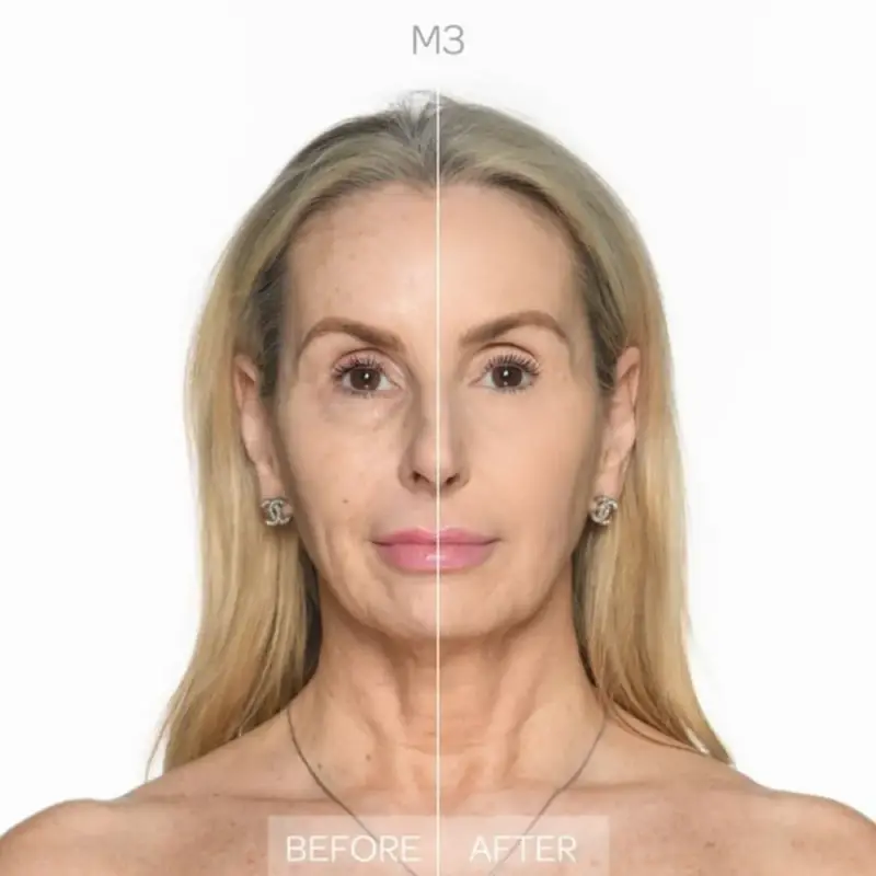 Viso Full Impact Concealer Medium 3 - Correttori miniatura 3