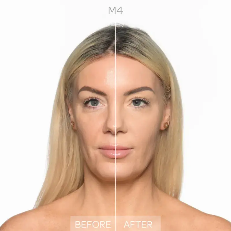 Viso Full Impact Concealer Medium 4 - Correttori miniatura 2