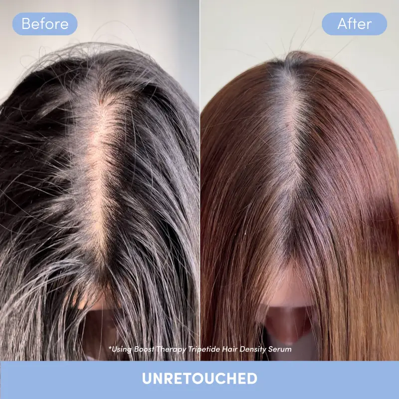 Boost Therapy Tripeptide Hair Density Serum - Siero capelli miniatura 4