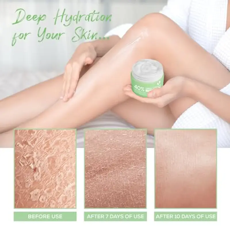 Crema Urea, Urea Crema al 40%, con Acido Ssalicilico al 2% e Acido Ialuronico, Melaleuca e Aloe Vera per Un'idratazione Profonda, per Piedi, Mani, Talloni, Gomiti, Unghie e Ginocchia miniatura 2