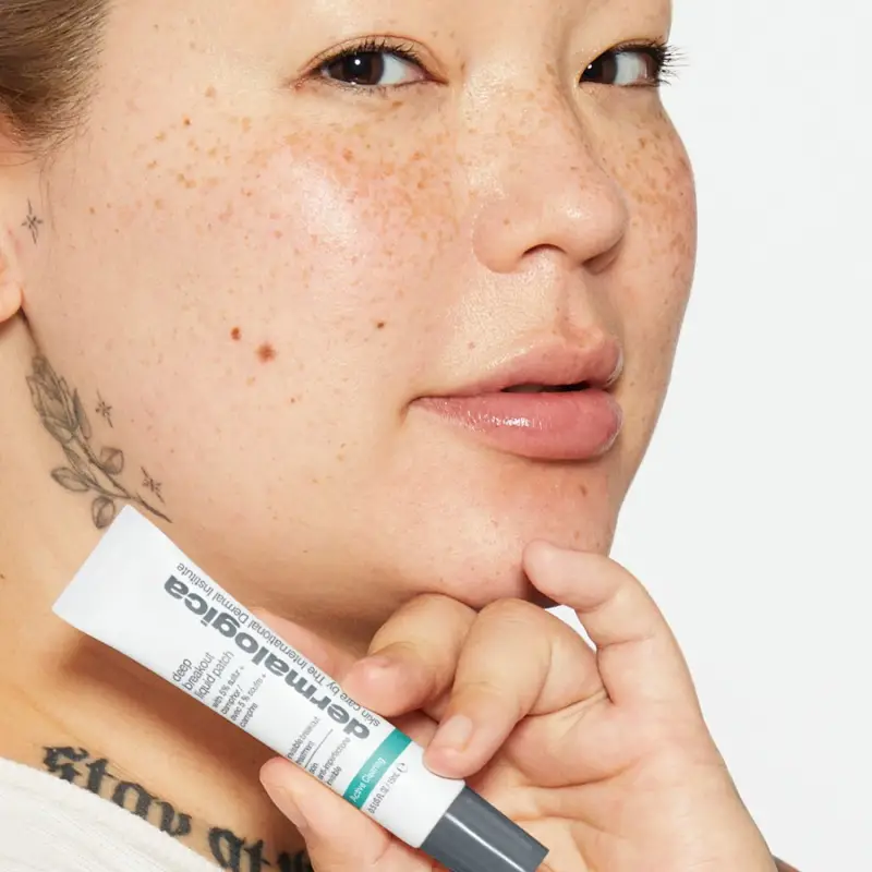 Active Clearing Deep Breakout Liquid Patch - Crema viso pelle grassa miniatura 2