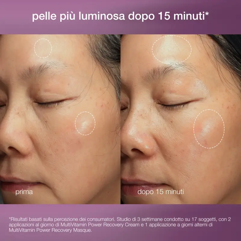 Multivitamin Stressed Skin Recovery System kit - Cofanetto antirughe miniatura 3
