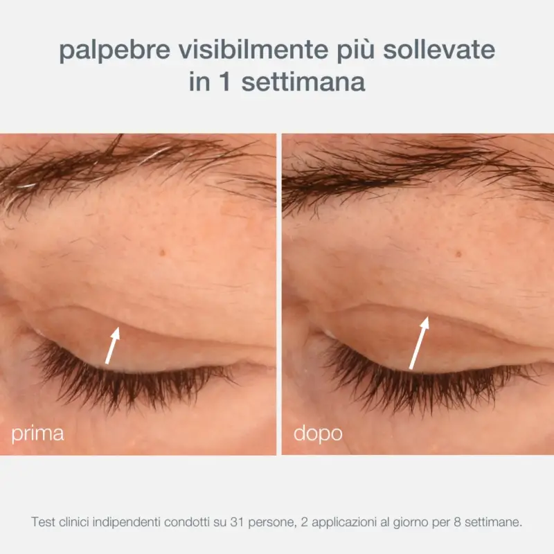 Phyto Nature Phyto Nature Lifting Eye Cream - Contorno occhi miniatura 4