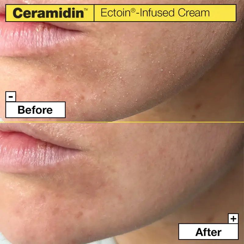 Ceramidin™ Ectoin-Infused Cream - Crema idratante viso miniatura 3