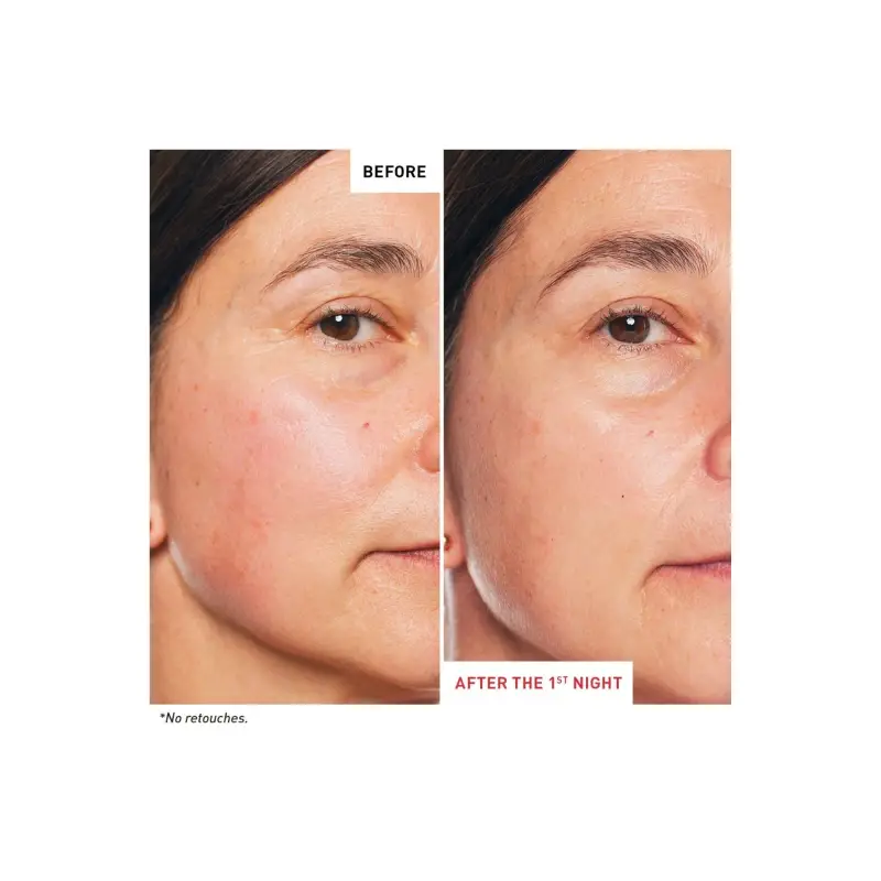 Super Ingredients Skin Therapy Night Oil - Crema antirughe, Olio viso antirughe miniatura 4