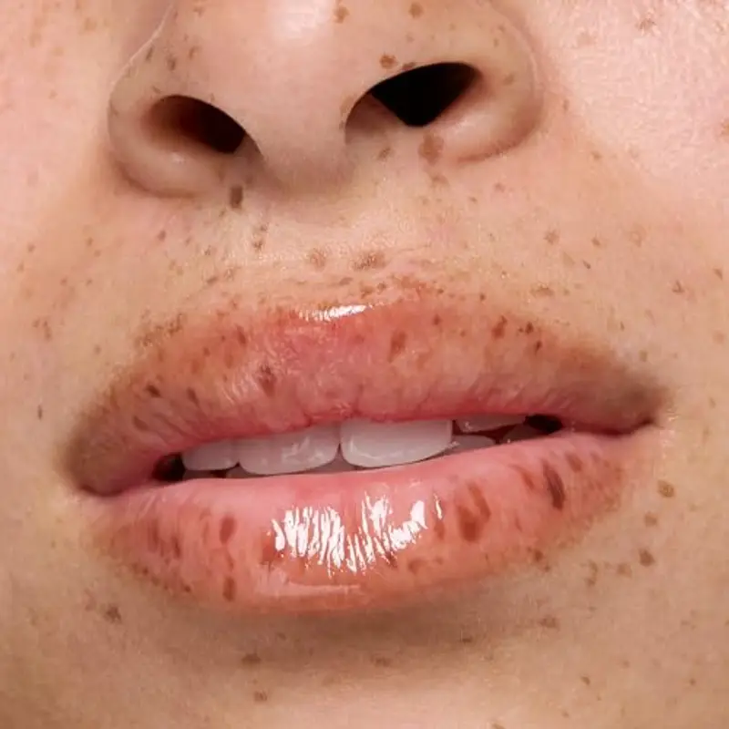 Essence Cosmetics Hydra Kiss Olio Labbra, Idratante, Curativo, con Oli, Lucida, Rugiadosa, 4 ml miniatura 3