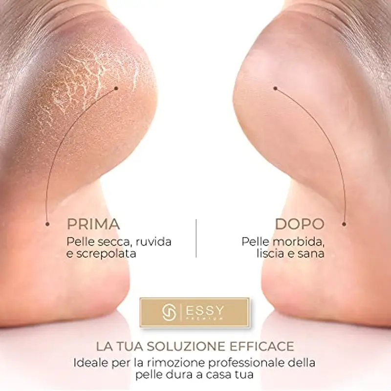 Essy Pedicure Elettrico Professionale Piedi Calli Talloni Screpolati Lima Elettrica per Piedi Togli Calli Pelle Secca Dura Raspa Piedi Professionale Esfoliante Kit per Duroni (White) miniatura 3