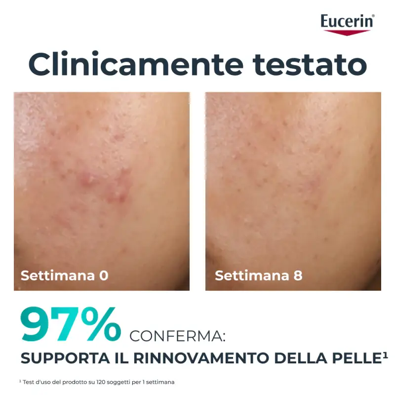 Dermopure Trattamento Rinnovatore - Crema viso pelle grassa miniatura 2