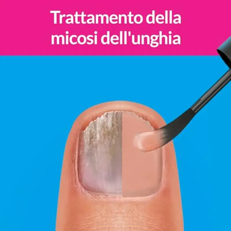 Excilor Micosi dell’Unghia Forte Color, Smalto Nude per Trattamento della Micosi dell'Unghia Attivo Contro le micosi Persistenti, Confezione con Trattamento Colorato 30 ml e Smalto Cosmetico 8 ml miniatura 3
