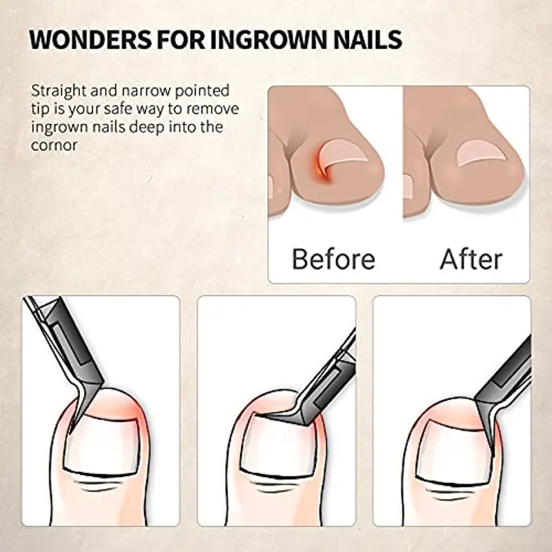 FERYES Wide Jaw - Pinza per unghie con lama diritta per unghie incarnite e unghie spesse, in acciaio inox e punta appuntita per unghie professionali per unghie dei piedi - Wide Jaw miniatura 3