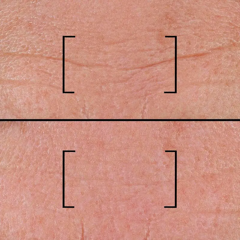 Time Time Filler Intensive 5xp - Trattamento antietà pelli mature, Siero antirughe miniatura 3