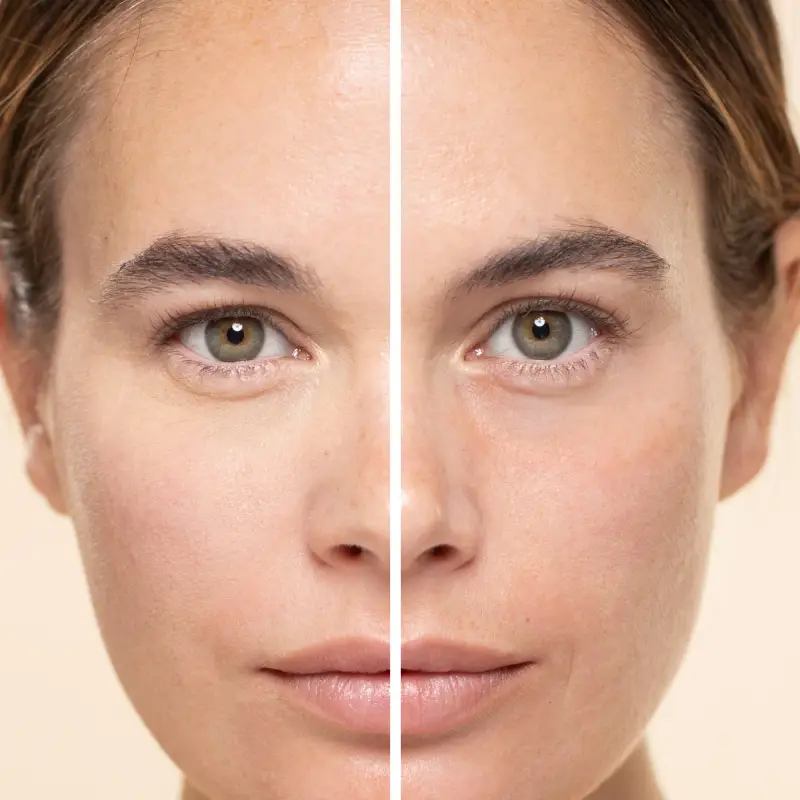 Incarnato Vitamin Fix Concealer 100 - Correttori miniatura 5