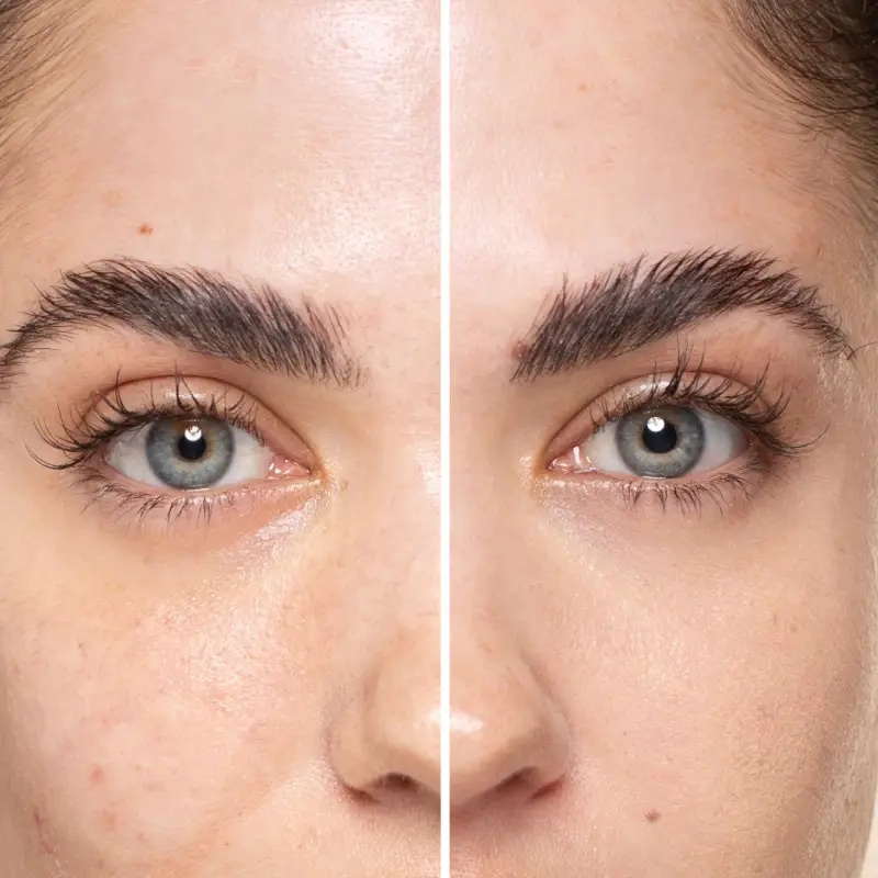 Incarnato Vitamin Fix Concealer 300 - Correttori miniatura 5