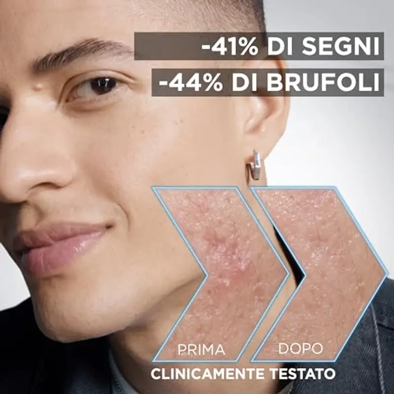 Garnier Siero Anti-imperfezioni, Per Pelle Grassa, Impura e Mista, Contrasta Punti Neri e Brufoli, Formula Vegana* con miniatura 2