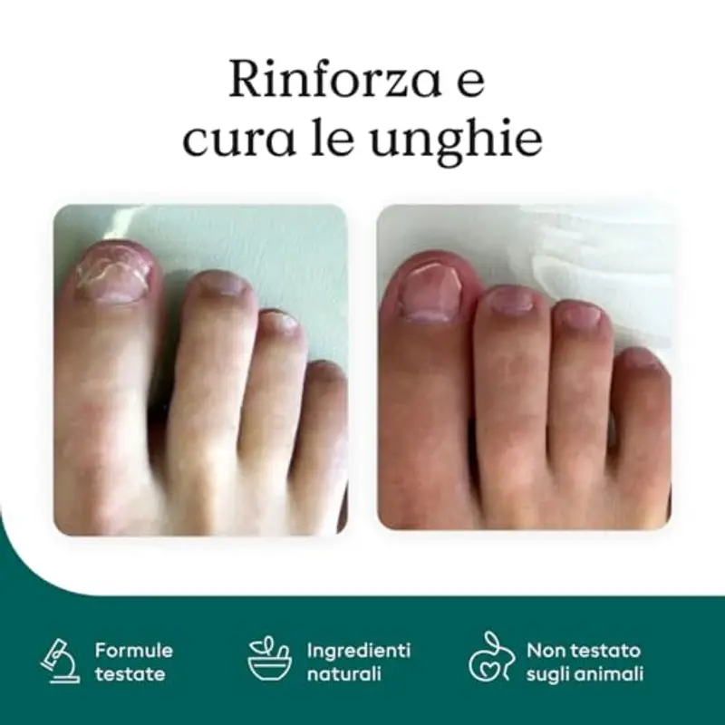 Health Routine Nail Care Pen 2 Pcs – L'Originale | Cura Cosmetica in Caso di Infezione Fungina delle Unghie in Modo miniatura 2