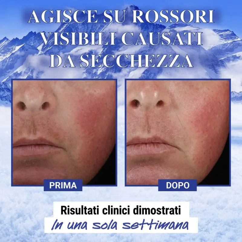 KIEHL'S - Idratanti Ultra Facial Advanced Repair Barrier Cream - Crema idratante viso miniatura 5