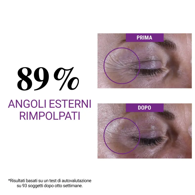 KIEHL'S - Labbra e Occhi Super Multi-Corrective Eye Zone Treatment - Contorno occhi miniatura 4