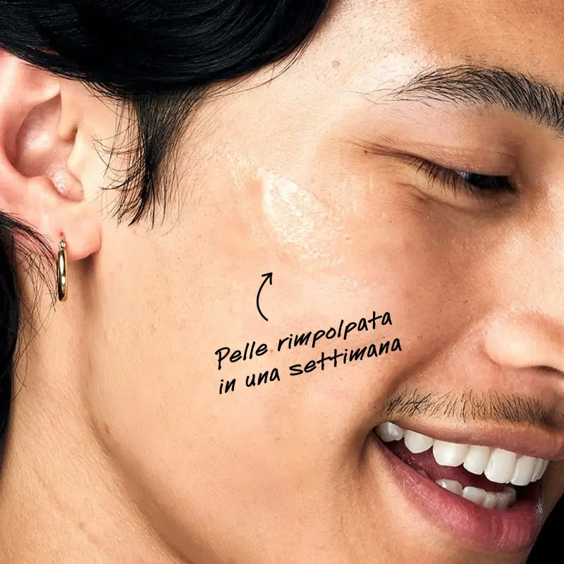 KIEHL'S - Sieri Ultra Pure High-Potency Serum 1.5% Acido Ialuronico - Trattamento antietà pelli mature, Siero antirughe miniatura 5