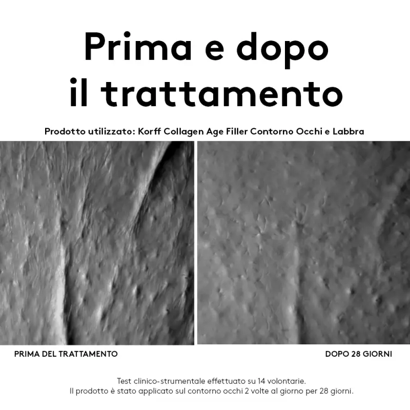Collagen Age Filler Contorno Occhi e Labbra - Balsamo labbra, Contorno occhi miniatura 3