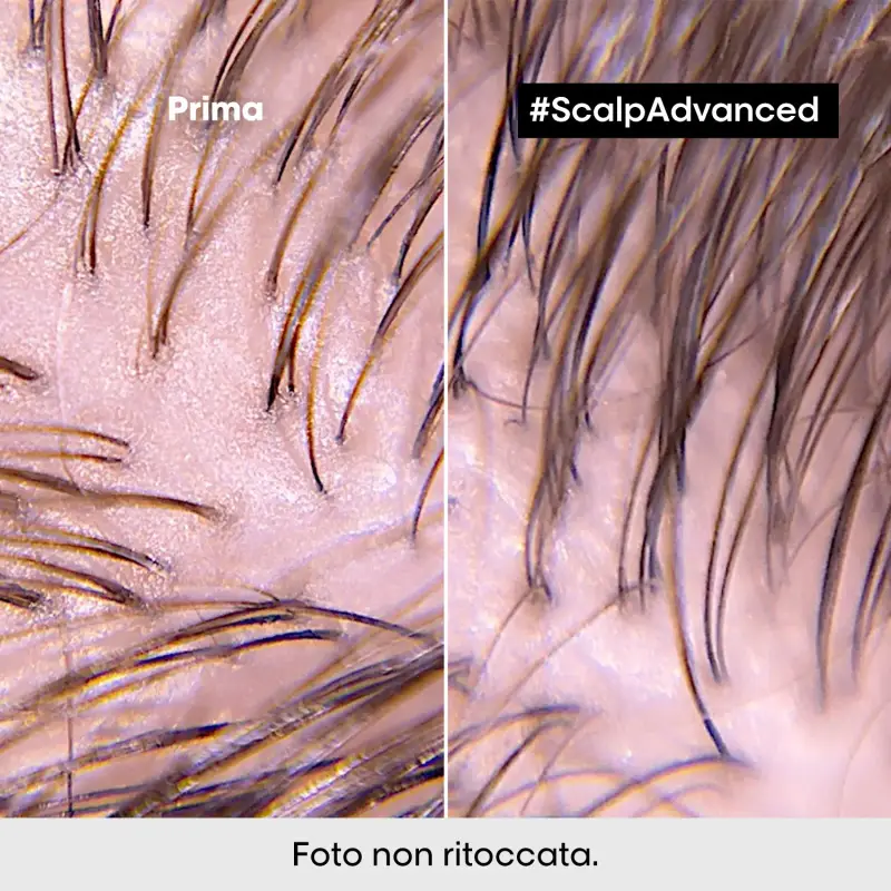 SERIE EXPERT New Scalp Advanced 2-in-1 Deep Purifier Clay Anti-Oiliness - Shampoo purificante, Maschera capelli grassi, Capelli miniatura 4