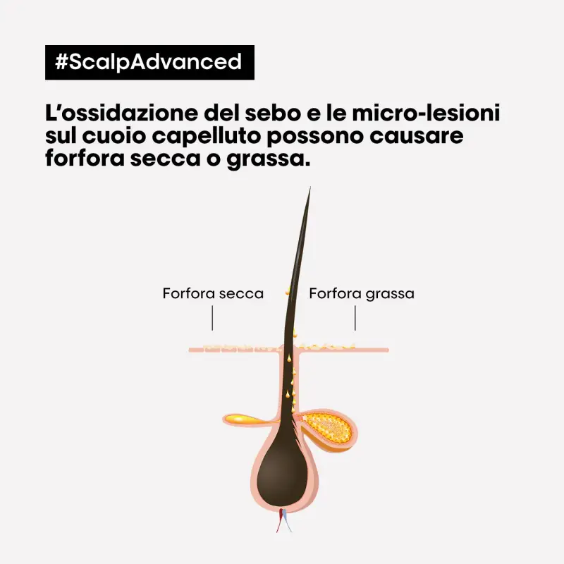 SERIE EXPERT New Scalp Advanced Shampoo Anti-Dandruff - Shampoo antiforfora, Forfora miniatura 2