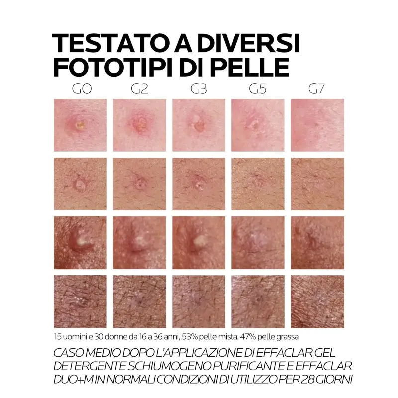 Effaclar Effaclar Duo+M Trattamento Viso Anti-imperfezioni - Crema viso pelle grassa miniatura 3