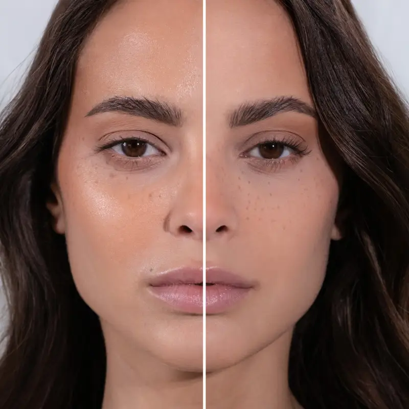 MESAUDASKIN MATTEREALIST™- Booster Opacizzante - Siero viso antimacchie miniatura 4