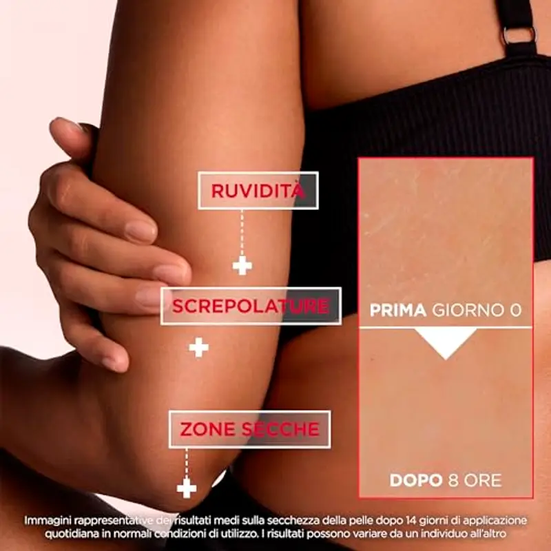 Mixa Crema Corpo Rigenerante, Per Pelle Secca e Ruvida, Pelle Idratata e Lenita per 48H, Barriera Cutanea Riparata e Protetta, Con il 10% di Urea e Niacinamide, Urea Cica Repair +, 400 ml miniatura 3