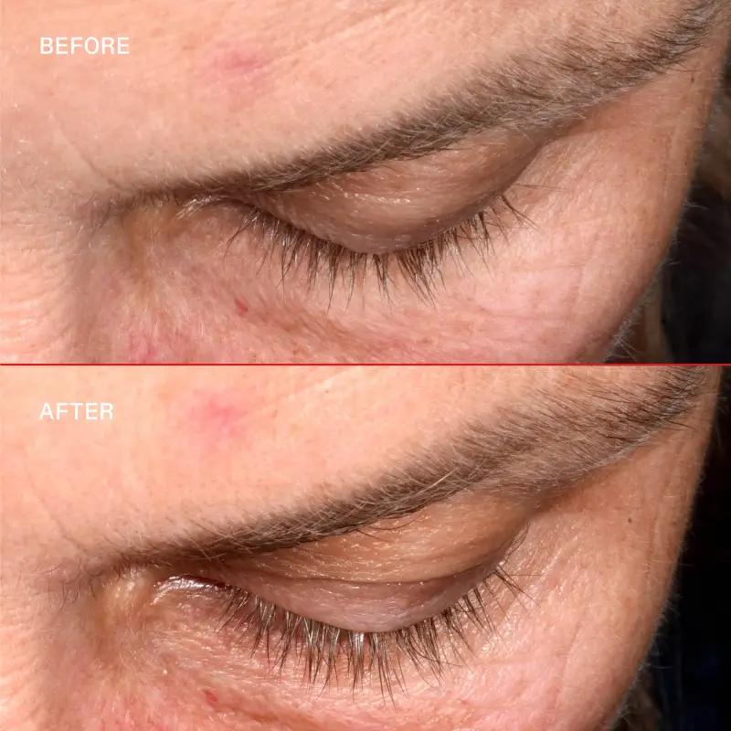 Ciglia LASHBOND™ Building Serum - Siero per ciglia miniatura 4