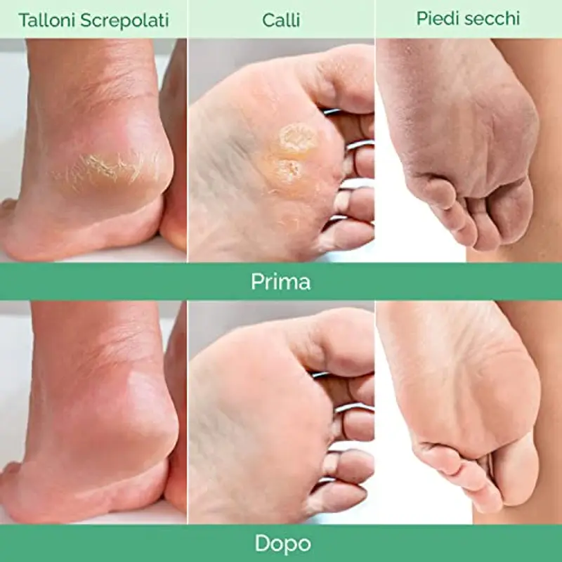 PLANTIFIQUE Maschera Piedi Esfoliante | Trattamento Calli e Duroni | Cura e Scrub Piedi | Peeling Piedi Forte | Pulizia Talloni Screpolati | Foot Peel Mask Calzini Pedicure Peel Off | Combo 4 Paia miniatura 3
