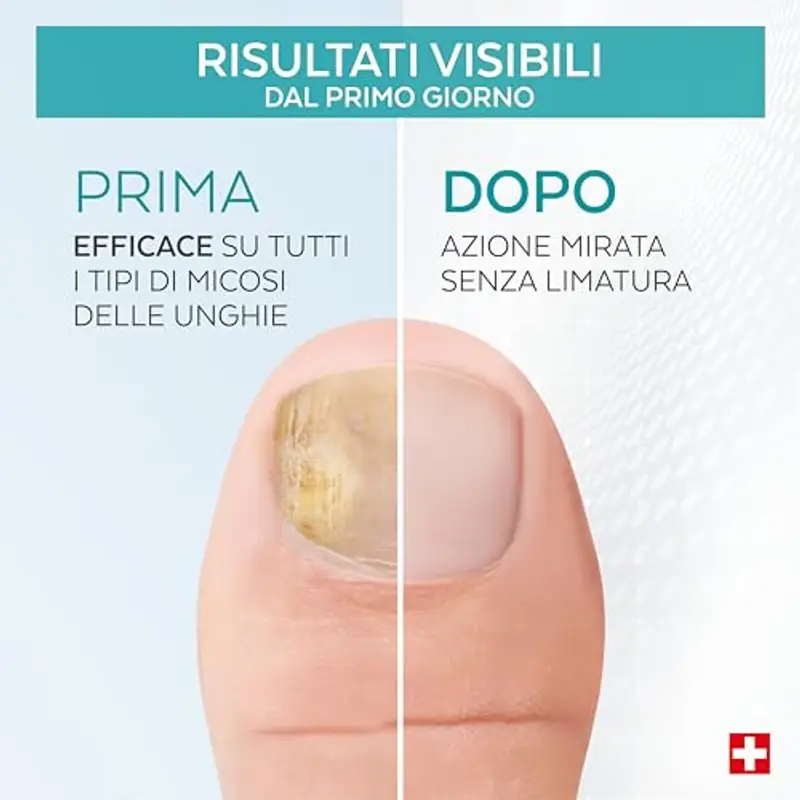 PODERM - MICOSI DELLE UNGHIE TRATTAMENTO 2 in 1 - A base di erbe con straordinarie qualità antimicotiche e riparatrici - Trattamento professionale mani/piedi - Facile e rapido - Swiss Made miniatura 3