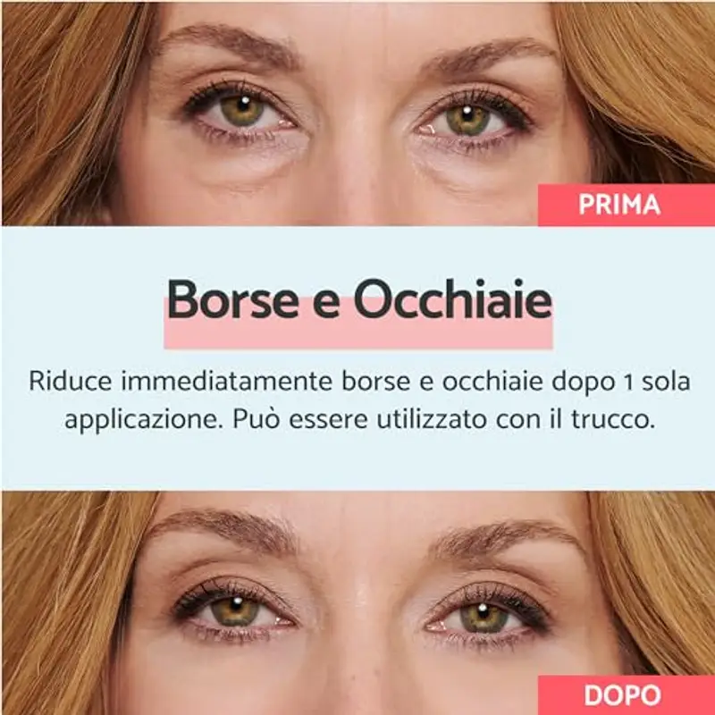 Remescar Crema Borse e Occhiaie 8ml – Trattamento Istantaneo Contorno Occhi per Borse e Occhiaie – Crema Defaticante Uomo Donna con 180 Applicazioni miniatura 2