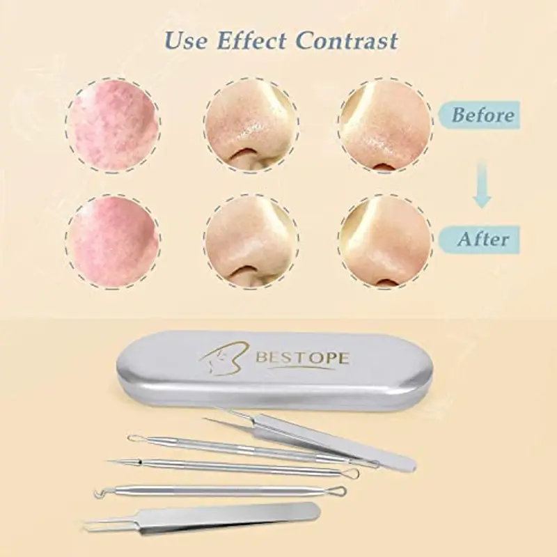 Rimozione di punti neri, set di rimozione dell'acne da 6 pezzi - Set di pinzette con custodia in metallo Strumento per miniatura 2
