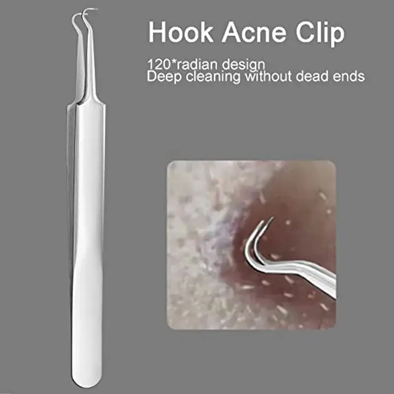 Rnitle strumenti Rimozione Punti Neri Naso Punti Bianchi, Acne[5 Pezzi], Brufoli Zit Incarniti, Adatto A Uomini E Donne, Acciaio inossidabile miniatura 3
