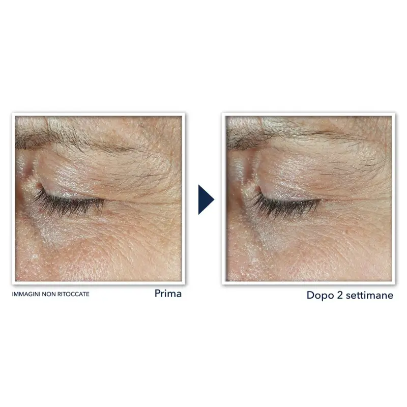 Derm Correxion Crema Contorno Occhi - Contorno occhi miniatura 4