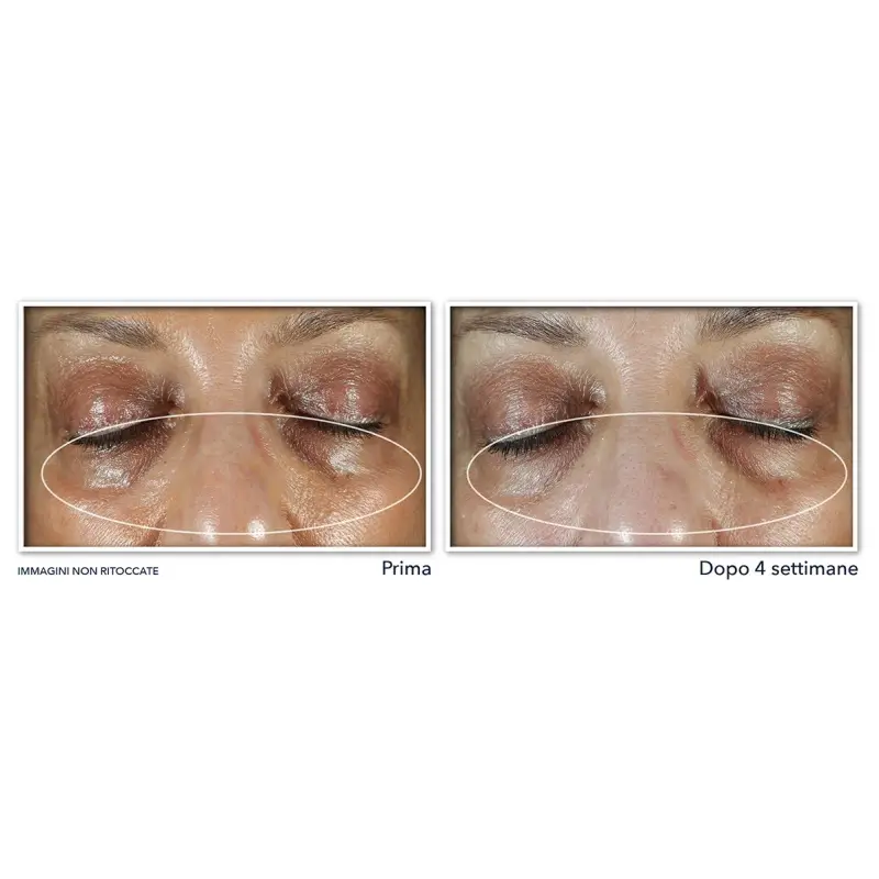 Multi Correxion Even Tone + Lift Crema Contorno Occhi - Contorno occhi miniatura 4