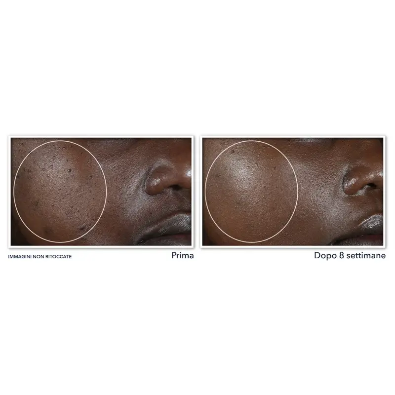 Multi Correxion Even Tone + Lift Crema Notte - Trattamento viso effetto lifting, Crema antimacchie viso, Crema viso pelle grassa miniatura 4