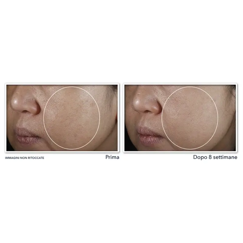 Multi Correxion Even Tone + Lift Crema Notte - Trattamento viso effetto lifting, Crema antimacchie viso, Crema viso pelle grassa miniatura 5