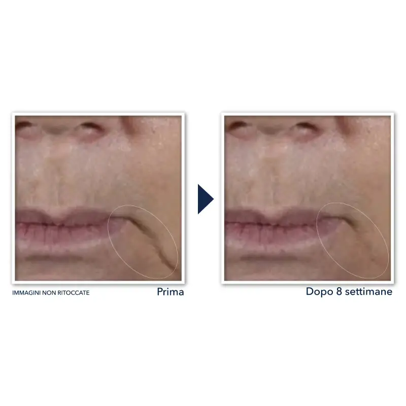 Multi Correxion Firm + Lift Crema Viso - Trattamento viso effetto lifting miniatura 4