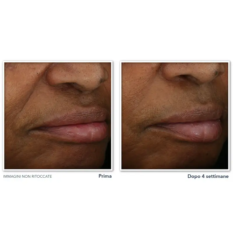 Multi Correxion Revive + Glow Crema Viso Gel - Trattamento viso antirughe miniatura 4