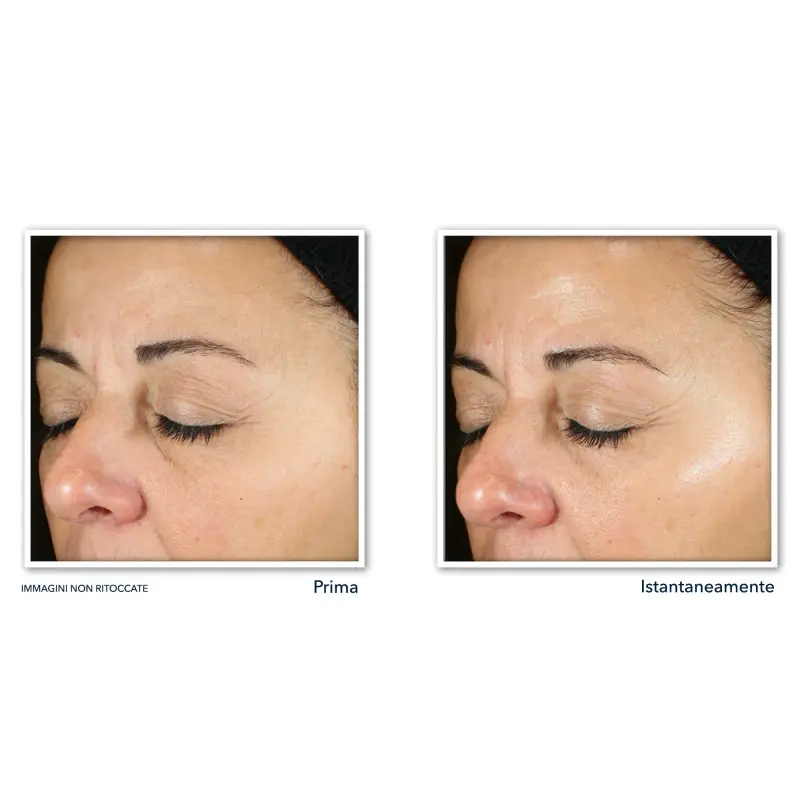 Multi Correxion Revive + Glow Siero Viso - Siero viso illuminante miniatura 4